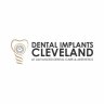dentalimplantscleveland